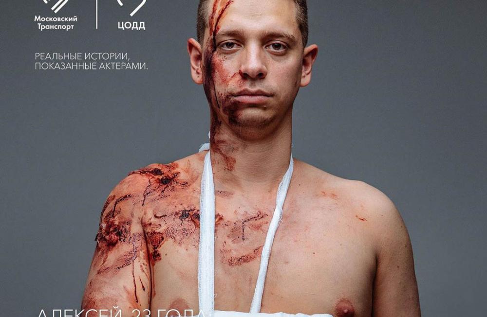 Владельцам электросамокатов сделали кровавое предупреждение
