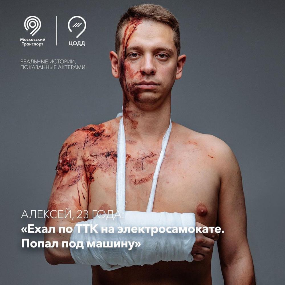 Владельцам электросамокатов сделали кровавое предупреждение