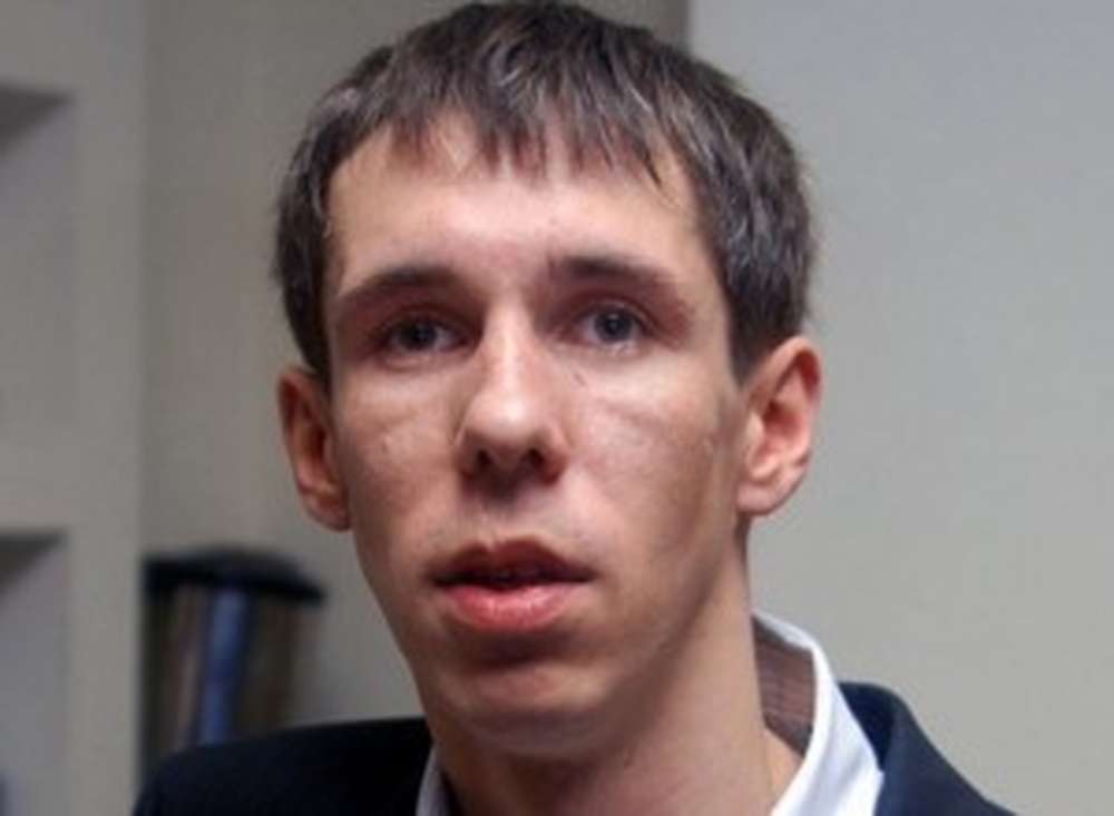 Актер Алексей Панин разбил лицо в ДТП в Сочи